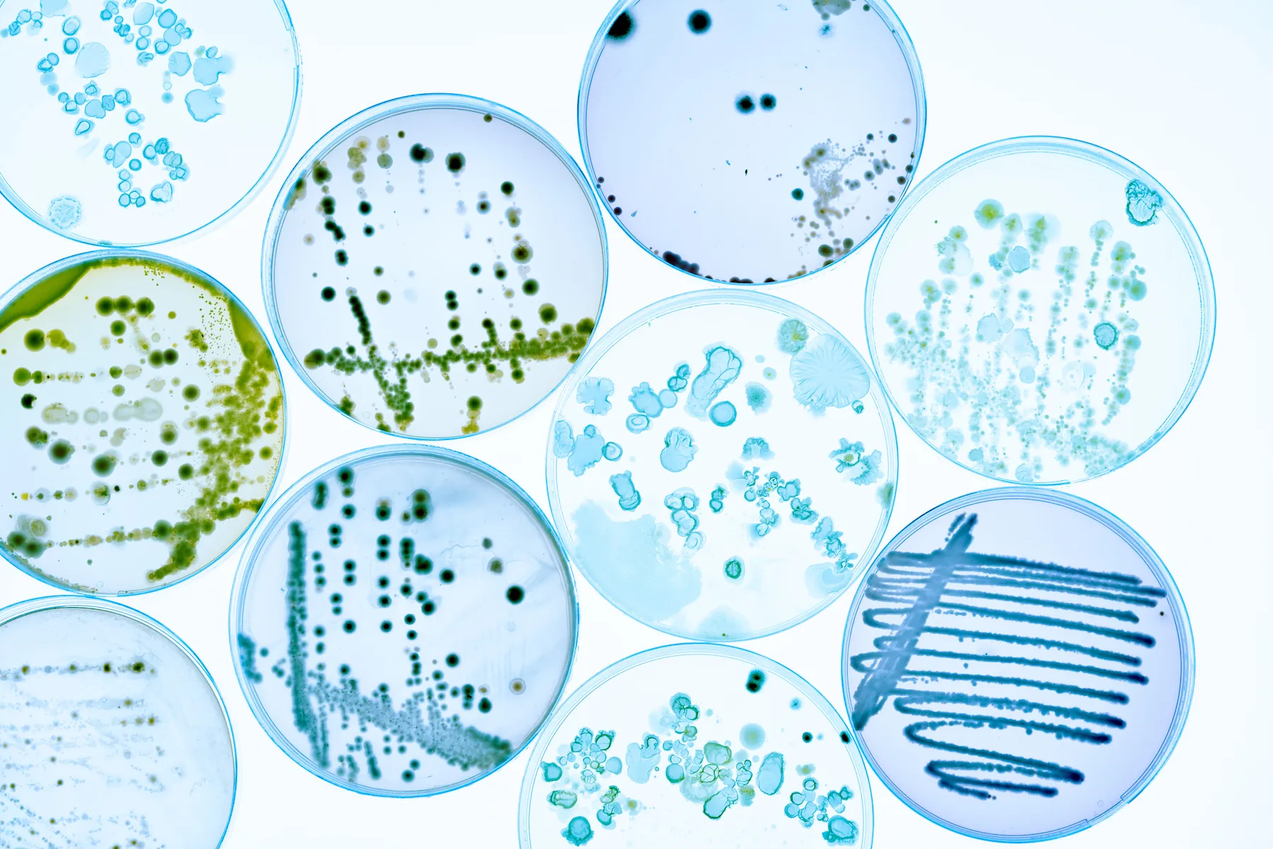 Petri dishes with bacterial samples against a backlit background.